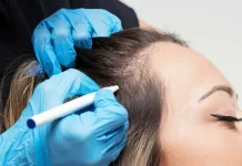 Hair Loss and Modern Medicine – What’s Next for the Future of Restoration